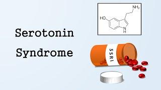 Serotonin Syndrome