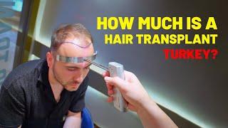 Hair Transplant Turkey - 2024