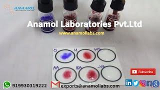 Widal 4x5 ml Test | Widal Test Procedure-In English