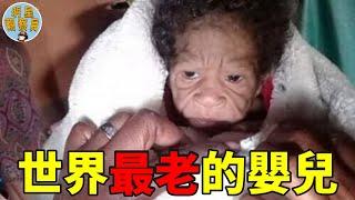 世界最「老」的女嬰，一出生就比奶奶還老，母親日日以淚洗面｜早衰｜明星觀察員