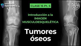 15.5 - Tumores óseos: Semiología radiológica básica y tumores mas comunes