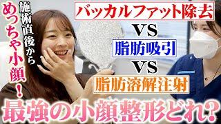 【小顔整形】バッカルファット除去・脂肪吸引・脂肪溶解注射どれが一番効果的？女医が解説！