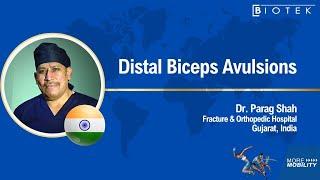 Distal Biceps Avulsions, Dr. Parag Shah, Fracture & Orthopedic Hospital Ahmedabad,  Gujarat, India