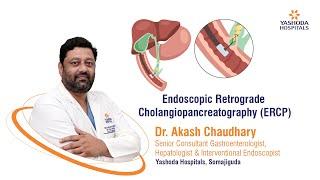 Endoscopic Retrograde Cholangiopancreatography | ERCP | Yashoda Hospitals Hyderabad