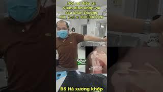 Nội Soi Điều Trị Viêm Dính Khớp Vai Sau Chấn Thương