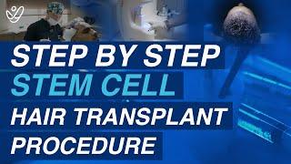 Transform Your Hair: Step-by-Step Stem Cell Hair Transplant