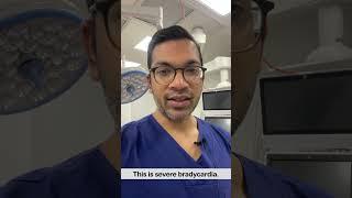 Diagonising Complete Heart Block | #shorts #ivcannulation #anesthesiology #nurse