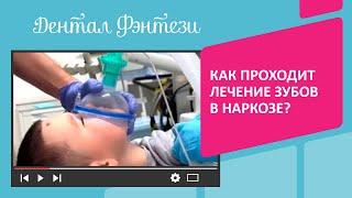 Как проходит лечение зубов в наркозе Смотрите видео до конца Задавайте ваши вопросы️