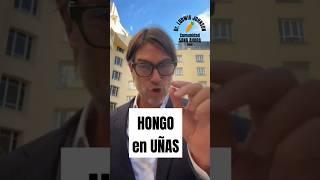 Como eliminar HONGOS en las UÑAS | Dr Ludwig Johnson #ludwigjohnson #hongosenlasuñas #shorts