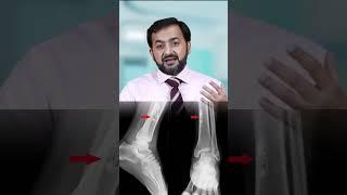 Stage 4 Breast Cancer Explained By | Dr. Hammad Sheikh | Doc Salah