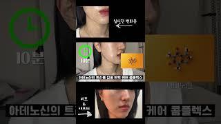 이거한번 봐봐 주름이 어떻게 사라지는지