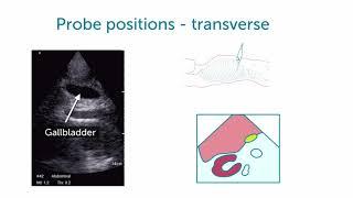 Views of Gallbladder Ultrasound and Bile Duct Imaging
