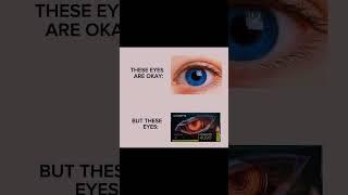 Human Eye is OK... But Have You Seen the RTX 4090?