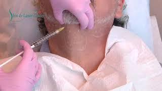 Dr. Marty Zaiac gets treated with Kybella for Double Chin