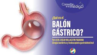 ¿Qué es un balón gástrico?