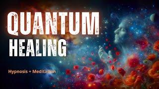 Quantum Healing: Guided Meditation + Hypnosis | Reprogramming the Subconscious (better quality)