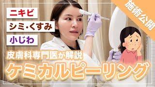 つるつる美肌に！肌質改善ケミカルピーリングの効果・注意点【皮膚科専門医】