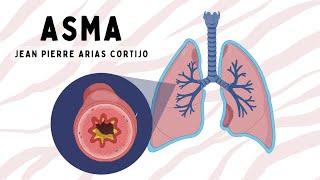 ASMA: Fisiopatología, Clínica, Diagnóstico, Manejo y Crisis Asmática