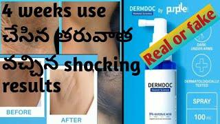 DERMDOC 5%Glycolic acid// dark neck /#darkunderarmspray #darkunderarms