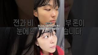 너만 모르는 효과 좋은 미백제품 #미백 #앰플 #미백앰플 #미백크림 #추천