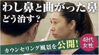 曲がった鼻と鷲鼻を美容整形でどう治す？鼻の形に悩む40代女性のカウンセリングをお見せします【リッツ美容外科】#鼻整形