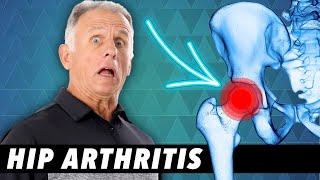 Top 3 Signs Your Hip Pain Is From Arthritis-Tests You Can Do at Home.