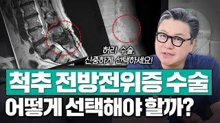 척추 전방전위증 수술, 어떻게 선택해야 할까? | 척추 MRI 소견 | 참포도나무병원 이동엽 원장