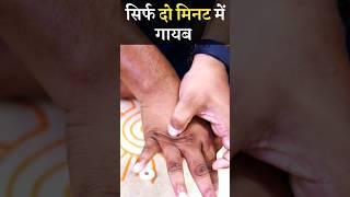 powerful massage for sciatica #youtubeshorts #shorts #shortsfeed #apakahealthguru #sciatica