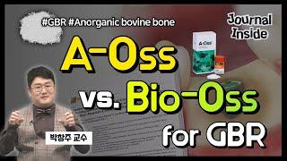 [Journal Inside] A-Oss vs. Bio-Oss for GBR