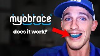 Watch this before you Buy Myobrace…Orthodontist Reviews