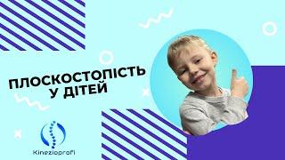 ПРОФІЛАКТИКА ПЛОСКОСТОПОСТІ У ДІТЕЙ. ВПРАВИ ДЛЯ СТОПИ