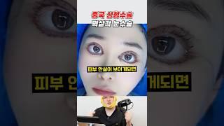요즘 인기있는 중국 성형수술