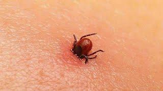 10 MOST Dangerous Bugs That Will Kill You