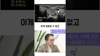 갑상선암 수술, 위험하지 않습니다. Thyroid cancer #쉬운건강