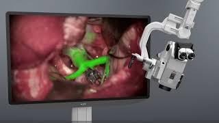 Surgical visualization solutions with Leica Microsystems