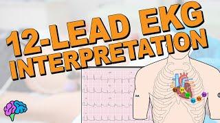 The COMPLETE 12-Lead EKG Masterclass!