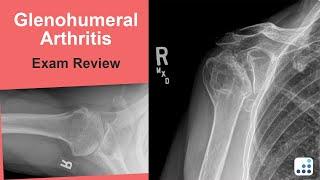 Glenohumeral Arthritis Exam Review - Anthony Romeo, MD