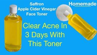 How To Make SAFFRON And APPLE CIDER VINEGAR  FACE TONER To Unclog Pores And Clear Hyper-Pigmentation