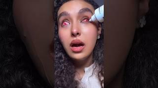 Part 2  trying to remove sclera lenses!! ‍️ #nouhailaait__