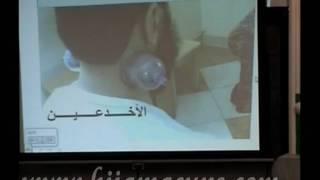 Equiptment & techniques to perform Hijama by hijamacups com  Part 9