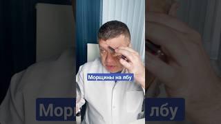 Почему появляются горизонтальные морщины на лбу и что с ними делать?