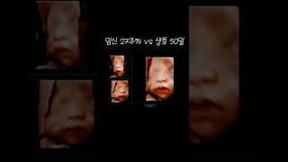 태어난지 50일 된 차니, 어떤가요 그대로 인가요? #리니차니 #차니 #성장기록 #50days #koreanbaby #babyboy