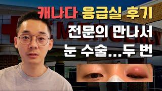 공짜로 눈 수술...그것도 두 번... 했습니다 | 캐나다 밴쿠버 워크인 클리닉 응급실 병원 이용 후기, 질병 감염 전문의 만나기, 항생제, 의료 시스템, MSP 보험