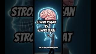 Stroke Ringan VS Stroke Berat, Jangan Salah Tau!