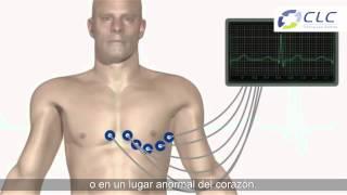 Procedimiento cardiología: Electrocardiograma [Clínica Las Condes]