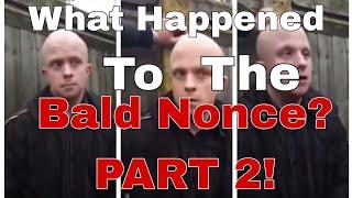 Ryan Holmes: What Happened to the Bald Nonce? (Part 2!)