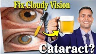 Ayurvedic Secrets to Heal Cataracts Naturally