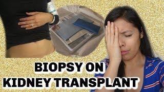WHAT DOES A KIDNEY TRANSPLANT BIOPSY CONSIST OF! KIDNEY BIOPSY! 2 YEAR POST KIDNEY TRANSPLANT!