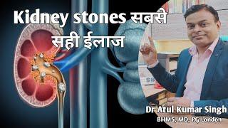 क्या किडनी स्टोन के लिए ऑपरेशन ज़रूरी है ? How Homeopathy deals with kidney stone I News Time Media