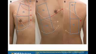 POCUS for Covid19